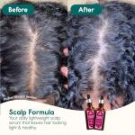 Nature Spell Scalp Serum for Dry, Itchy Relief