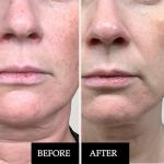 Kleem Organics Anti-Aging Skincare Trio Set