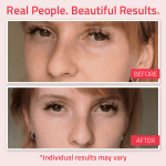 Retinol Eye Cream for Dark Circles and Puffiness