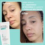 Daily Exfoliator for Clear Skin with Niacinamide