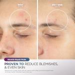 Shark CryoGlow LED Brightening Eye Mask