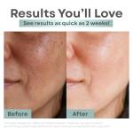 Clear Essence Anti-Aging Toner with AHA, 8oz