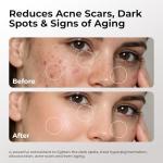 Vitamin C & E Serum with Ferulic Acid 30ML