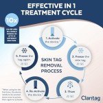 Skin Tag Remover - FDA-Cleared Cryogenic Device