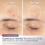 Shark CryoGlow LED Face Mask for Skincare