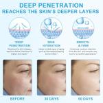 Hyaluronic Acid Serum Powder for Radiant Skin