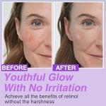 Korean Bakuchiol Anti-Aging DIY Serum 1 oz