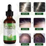 Pure Organic Rosemary Oil for Hair Growth 60ml