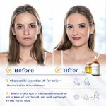 Chamomile Essential Oil - 30ML Pure & Natural