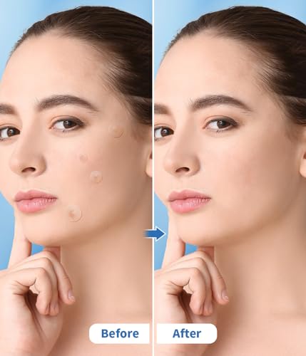 TARVY Organic Acne Patches with Salicylic Acid