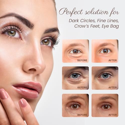 Caffeine Eye Serum for Dark Circles & Puffiness