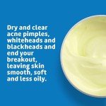 De La Cruz Sulfur Ointment for Acne Treatment