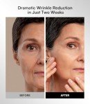 INIA Wireless LED Red Light Therapy Face Mask
