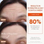ESTANANA LED Red Light Therapy Face Mask