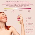 Gentle Hypochlorous Acid Spray for Skin Relief