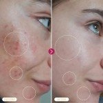 Gentle Hypochlorous Acid Spray for Skin Relief