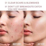 Natura Mist Hypochlorous Acid Spray for Sensitive Skin