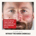 Gentle Hypochlorous Acid Face and Eye Spray