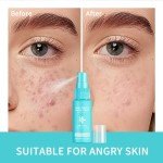 Soothing Daily Facial Spray - 100% Natural & Vegan