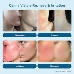 Honeydew Labs Hypochlorous Acid Spray for Sensitive Skin