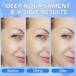 GOGIFTGO Deep Hydrating Collagen Face Mask Set