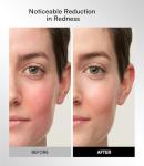 INIA Wireless LED Red Light Therapy Face Mask