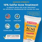De La Cruz Sulfur Ointment for Cystic Acne