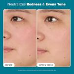 Paula's Choice Balancing Toner for Combination/Oily Skin, 6.4oz