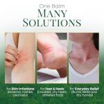 Chamuel Tea Tree Oil Balm for Skin Irritations