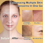 Hydrating Anti-Aging Skincare Gift Set for Women