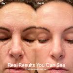 Solawave 4-in-1 Red Light Facial Wand