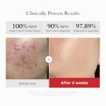 Exfoliating Toner Pads with Red Succinic Acid