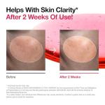 ANUA Niacinamide Glow Serum for Dark Spots