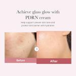 Medicube Pink Hyaluronic Cream for Blemished Skin