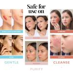 Hypochlorous Acid Face Mist for Clear Skin