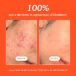 Tower 28 SOS Daily Rescue Facial Spray