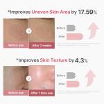 Medikiss Exosome Pink Collagen Facial Serum