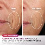 Shark CryoGlow LED Face Mask for Youthful Skin