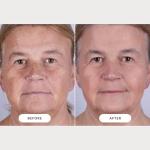 CurrentBody Skin LED Light Therapy Mask 2