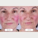 CurrentBody Skin LED Light Therapy Mask 2