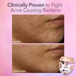 Dr. Dennis Gross LED Face Mask for Skin Rejuvenation