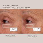 HigherDOSE LED Red Light Face Mask for Glowing Skin