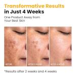 Turmeric & Kojic Acid Overnight Glow Mask 75ML