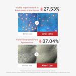 Hypochlorous Acid Peel Mask for Oily Skin