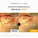 Mediheal Vita Collagen Hydrogel Under Eye Patches