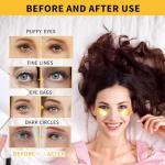 24K Gold Under Eye Masks for Puffiness Relief