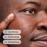 Salicylic Acid 2% Acne Serum for Blemishes