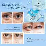 Hyaluronic Acid Under Eye Patches for Dark Circles
