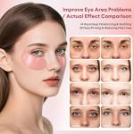 Gold Hydrogel Eye Masks for Dark Circles