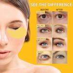 24K Gold Under Eye Masks for Dark Circles